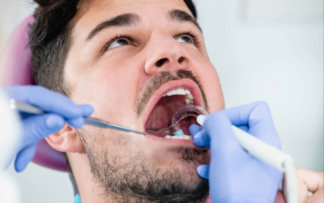 Mann liegt beim Zahnarzt mit geöffnetem Mund für eine Parodontitis-Behandlung. Eine Dentalfachkraft mit Handschuhen führt eine professionelle Zahnreinigung mit Spiegel und Absauggerät durch.