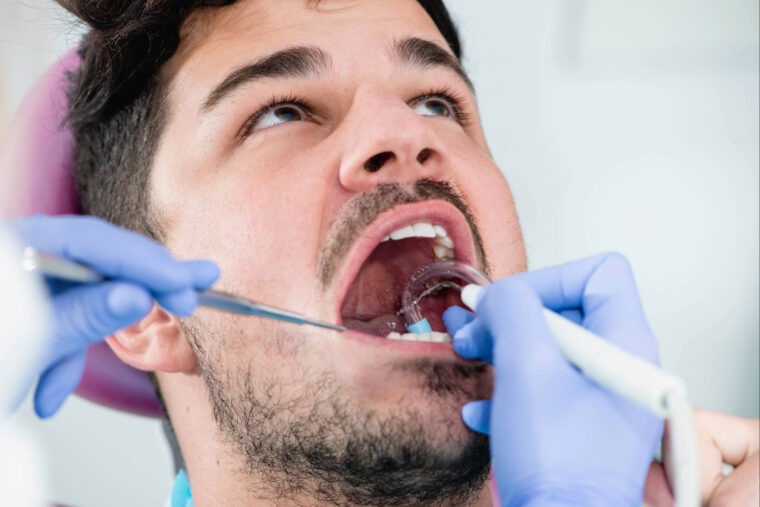 Mann liegt beim Zahnarzt mit geöffnetem Mund für eine Parodontitis-Behandlung. Eine Dentalfachkraft mit Handschuhen führt eine professionelle Zahnreinigung mit Spiegel und Absauggerät durch.