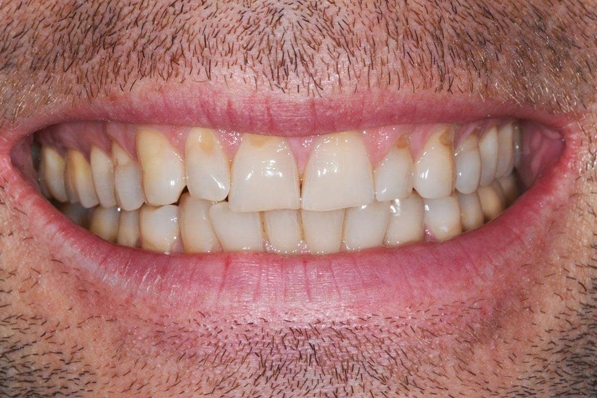 Patient vor der ästhetischen Zahnbehandlung