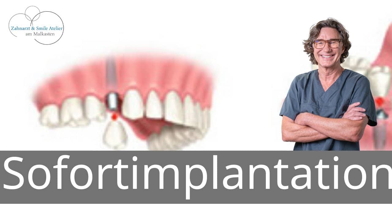 Vorschaubild Video: Sofortimplantation - Zahn raus- Implantat rein