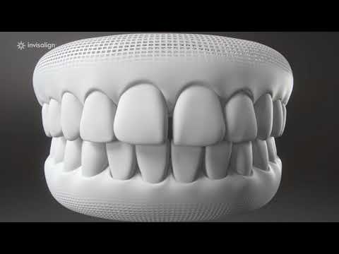 Vorschaubild Video: Invisalign