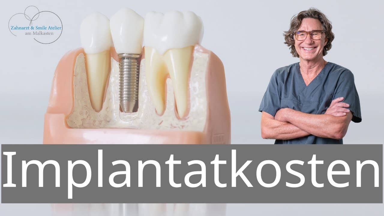 Vorschaubild Video: Was kosten Zahnimplantate